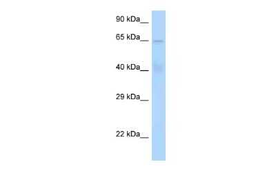 Western Blot: STAM-1 Antibody [NBP2-85836] - WB Suggested Anti-STAM Antibody. Titration: 1.0 ug/ml. Positive Control: Hela Whole CellSTAM is supported by BioGPS gene expression data to be expressed in HeLa