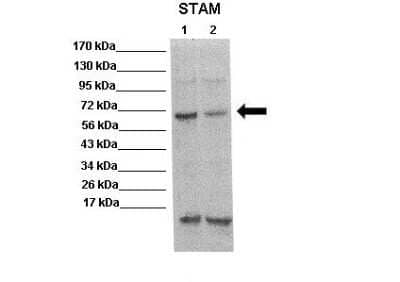 Western Blot: STAM-1 Antibody [NBP2-85836] - WB Suggested Anti-STAM Antibody. Positive Control: Lane 1: 20ug mouse brain extract Lane 2: 20ug mouse brain extract. Primary Antibody Dilution : 1:500. Secondary Antibody : Anti rabbit-HRP. Secondry Antibody Dilution : 1:5,000. Submitted by: Scott Wilson, University of Alabama at Birmingham