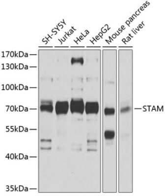 Western Blot: STAM-1 Antibody [NBP2-94882] - Analysis of extracts of various cell lines, using STAM-1 at 1:1000 dilution. Secondary antibody: HRP Goat Anti-Rabbit IgG (H+L) at 1:10000 dilution. Lysates/proteins: 25ug per lane. Blocking buffer: 3% nonfat dry milk in TBST. Detection: ECL Basic Kit . Exposure time: 15s.