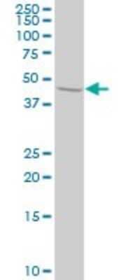 Western Blot: STAM2 Antibody (1A10) [H00010254-M01] - STAM2 monoclonal antibody (M01), clone 1A10 Analysis of STAM2 expression in HeLa.