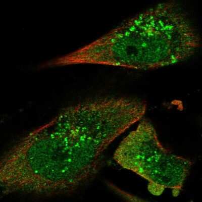 <b>Independent Antibodies Validation. </b>Immunocytochemistry/Immunofluorescence: STAM2 Antibody [NBP1-83288] - Staining of human cell line U-251 MG shows localization to nucleoplasm, cytosol & vesicles. Antibody staining is shown in green.