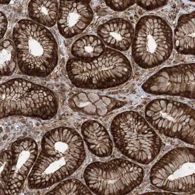 Immunohistochemistry-Paraffin: STAM2 Antibody [NBP1-83288] - Staining of human stomach shows strong cytoplasmic and membranous positivity in glandular cells.