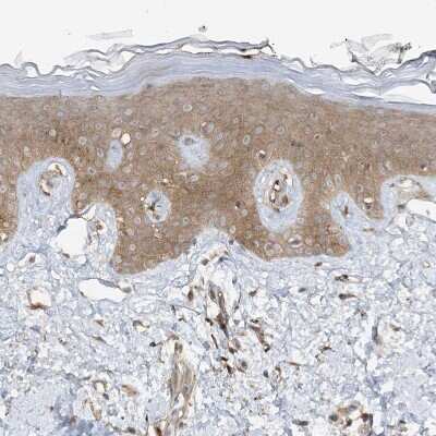 Immunohistochemistry-Paraffin: STAM2 Antibody [NBP1-83289] - Staining of human squamous epithelia shows moderate cytoplasmic positivity in squamous epithelial cells.