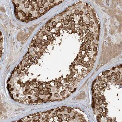 Immunohistochemistry-Paraffin: STAM2 Antibody [NBP1-83289] - Staining of human testis shows moderate cytoplasmic positivity in cells in seminiferous ducts.