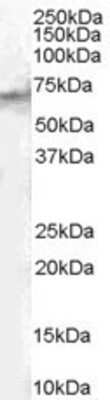 Western Blot: STAM2 Antibody [NB100-2838] - Staining of Human Spleen lysate (35 ug protein in RIPA buffer). Antibody at 1 ug/mL. Primary incubation was 1 hour. Detected by chemiluminescence.