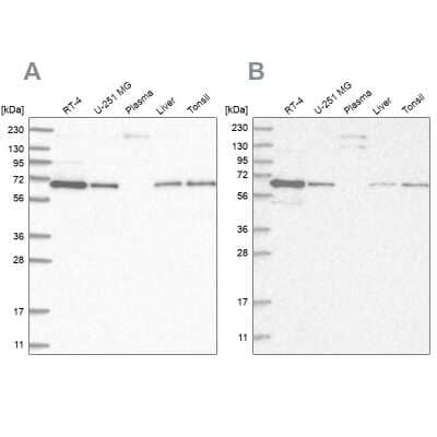 <b>Independent Antibodies Validation. </b>Western Blot: STAM2 Antibody [NBP1-83288] - Analysis using Anti-STAM2 antibody NBP1-83288 (A) shows similar pattern to independent antibody NBP1-83289 (B).