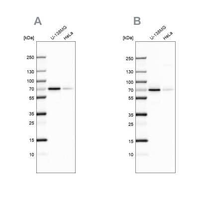 Western Blot: STAM2 Antibody [NBP1-83288] - Analysis NBP1-83288 (A) shows similar pattern to independent antibody NBP1-83289 (B).