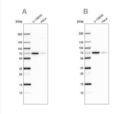 Western Blot: STAM2 Antibody [NBP1-83289] - Analysis using Anti-STAM2 antibody NBP1-83289 (A) shows similar pattern to independent antibody NBP1-83288 (B).