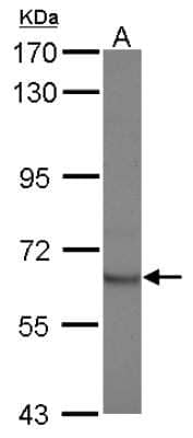 Western Blot: STAM2 Antibody [NBP2-20500] - Sample (30 ug of whole cell lysate) A: Jurkat 7. 5% SDS PAGE gel, diluted at 1:1000.