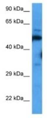 Western Blot: STAM2 Antibody [NBP3-09995] - Western blot analysis of STAM2 in Mouse Spleen lysates. Antibody dilution at 1.0ug/ml