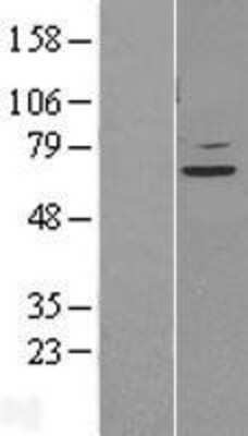 Western Blot: STAM2 Overexpression Lysate (Adult Normal) [NBL1-16510] Left-Empty vector transfected control cell lysate (HEK293 cell lysate); Right -Over-expression Lysate for STAM2.