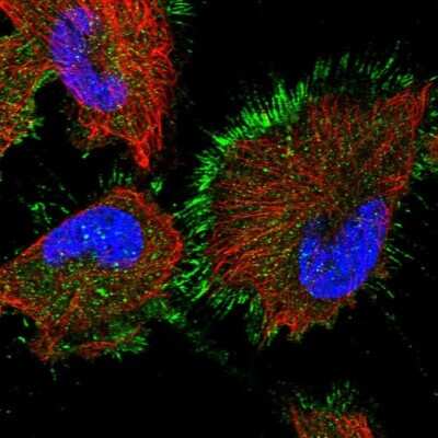 Immunocytochemistry/Immunofluorescence: AMSH-LP Antibody [NBP1-89135] - Staining of human cell line U-251 MG shows localization to plasma membrane.