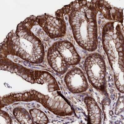 Immunohistochemistry-Paraffin: AMSH-LP Antibody [NBP1-89135] - Staining of human stomach shows strong cytoplasmic and membranous positivity in glandular cells.