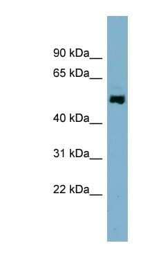 Western Blot: AMSH-LP Antibody [NBP1-56334] - Jurkat cell lysate, concentration 0.2-1 ug/ml.