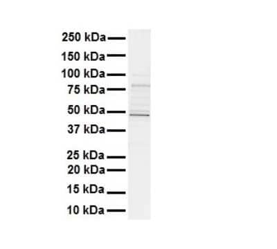 Western Blot: AMSH-LP Antibody [NBP1-56334] -  Antibody  Titration: 1 ug/ml Human MDA-MB-435s.