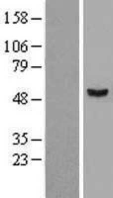 Western Blot: AMSH-LP Overexpression Lysate [NBL1-16513] -  Left-Empty vector transfected control cell lysate (HEK293 cell lysate); Right -Over-expression Lysate for STAMBPL1.
