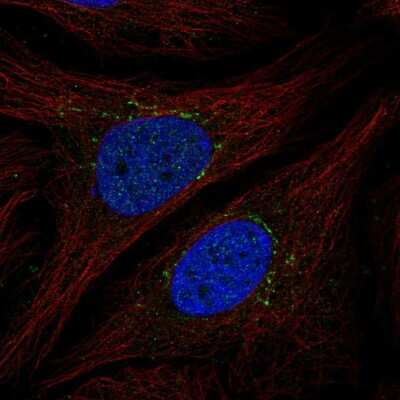 Immunocytochemistry/Immunofluorescence: STAMP2/STEAP4 Antibody [NBP2-56536] - Staining of human cell line SiHa shows localization to the Golgi apparatus. Antibody staining is shown in green.