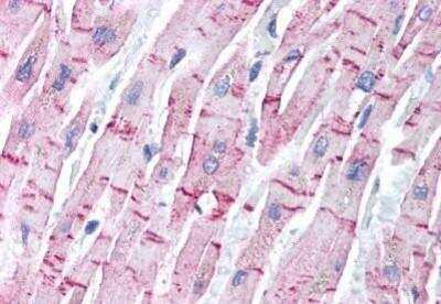 Immunohistochemistry-Paraffin: STAMP2/STEAP4 Antibody [NB100-80831] - STEAP4 Antibody [NB100-80831] - Staining of human heart formalin-fixed, paraffin-embedded tissue after heat-induced antigen retrieval. Antibody concentration 5 ug/ml.