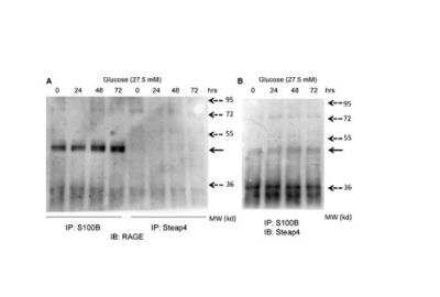 Immunoprecipitation STAMP2/STEAP4 Antibody