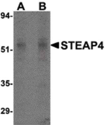 Western Blot: STAMP2/STEAP4 Antibody [NB100-80831] - Rat liver tissue lysate.
