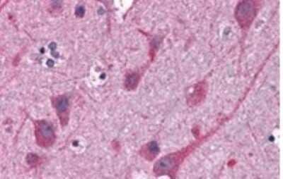 Immunohistochemistry-Paraffin STAP2 Antibody