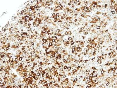 Immunohistochemistry-Paraffin: STAP2 Antibody [NBP1-33643] - Paraffin-embedded BT483 xenograft, using antibody at 1:100 dilution.