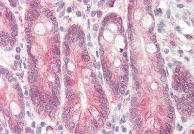 Immunohistochemistry-Paraffin: STAP2 Antibody [NBP1-51904] - Staining of paraffin embedded Human Small Intestine. Antigen at 3.75 ug/mL. Steamed antigen retrieval with citrate buffer pH 6, AP-staining.