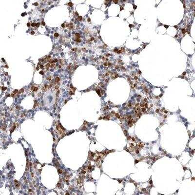 Immunohistochemistry-Paraffin: STAP2 Antibody [NBP1-88585] - Staining of human bone marrow shows strong cytoplasmic positivity in subsets of cells.