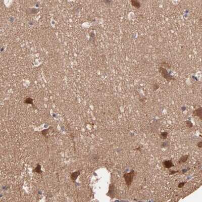 <b>Orthogonal Strategies Validation. </b>Immunohistochemistry-Paraffin: STAP2 Antibody [NBP1-88586] - Staining of human cerebral cortex shows strong cytoplasmic positivity in neuronal cells.