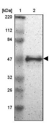 Western Blot: STAP2 Antibody [NBP1-88586] - Lane 1: Marker  [kDa] 220, 112, 84, 47, 32, 26, 17.  Lane 2: Human cell line RT-4