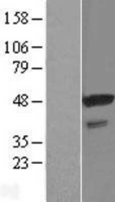 Western Blot: STAP2 Overexpression Lysate (Adult Normal) [NBL1-16515] Left-Empty vector transfected control cell lysate (HEK293 cell lysate); Right -Over-expression Lysate for STAP2.