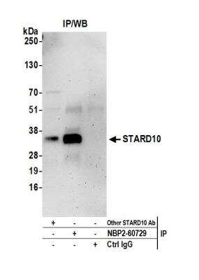 Immunoprecipitation: STARD10 Antibody [NBP2-60729] - Detection of human STARD10 by western blot of immunoprecipitates. Samples: Whole cell lysate (0.5 or 1.0 mg per IP reaction; 20% of IP loaded) from 293T cells prepared using NETN lysis buffer. Antibodies: Affinity purified rabbit anti-STARD10 antibody NBP2-60729 used for IP at 8 ul per reaction. STARD10 was also immunoprecipitated by another rabbit anti-STARD10 antibody. Detection: Chemiluminescence with an exposure time of 3 minutes.
