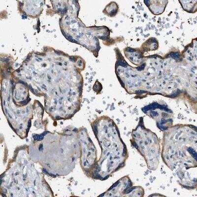 Immunohistochemistry: STARD13 Antibody [NBP1-94141] - Immunohistochemical staining of human placenta shows strong cytoplasmic positivity in trophoblastic cells.