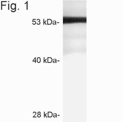 Western Blot: STARD3 Antibody [NB300-599] - Analysis of MLN64 on rat adrenal gland extract.