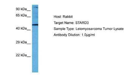 Western Blot: STARD3 Antibody [NBP2-86834] - Host: Rabbit. Target Name: STARD3. Sample Tissue: Human Leiomyosarcoma Tumor lysates. Antibody Dilution: 1ug/ml