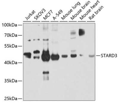 Western Blot: STARD3 Antibody [NBP2-94159] - Analysis of extracts of various cell lines, using STARD3 at 1:1000 dilution. Secondary antibody: HRP Goat Anti-Rabbit IgG (H+L) at 1:10000 dilution. Lysates/proteins: 25ug per lane. Blocking buffer: 3% nonfat dry milk in TBST. Detection: ECL Basic Kit . Exposure time: 15s.