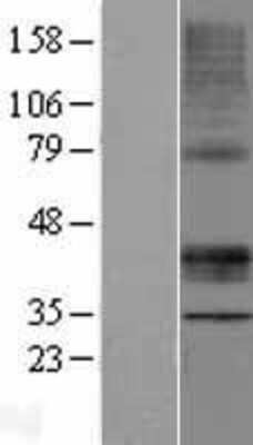 Western Blot: STARD3 Overexpression Lysate (Adult Normal) [NBP2-07577] Left-Empty vector transfected control cell lysate (HEK293 cell lysate); Right -Over-expression Lysate for STARD3.