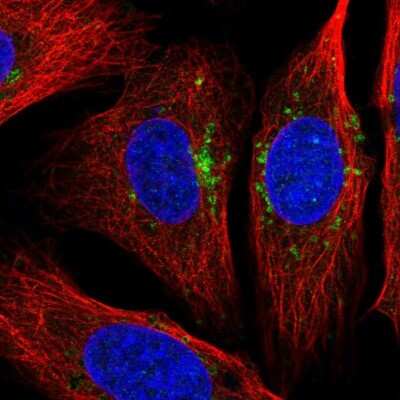 Immunocytochemistry/Immunofluorescence: STARD3NL Antibody [NBP1-93527] - Staining of human cell line U-2 OS shows localization to vesicles. Antibody staining is shown in green.