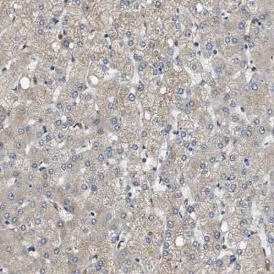 Immunohistochemistry-Paraffin STARD3NL Antibody