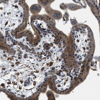 Immunohistochemistry-Paraffin STARD3NL Antibody