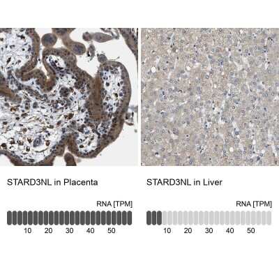 Immunohistochemistry-Paraffin STARD3NL Antibody