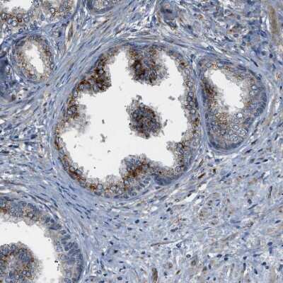 Immunohistochemistry-Paraffin: STARD3NL Antibody [NBP1-93527] - Staining of human prostate shows positivity in glandular cells.