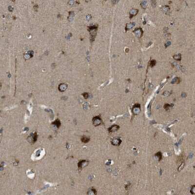 Immunohistochemistry-Paraffin: STARD3NL Antibody [NBP1-93527] - Staining of human cerebral cortex shows positivity in neurons.