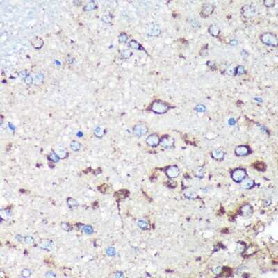 Immunohistochemistry-Paraffin: STARD3NL Antibody [NBP2-94673] - Immunohistochemistry of paraffin-embedded Rat brain using STARD3NL Rabbit pAb (NBP2-94673) at dilution of 1:100 (40x lens). Perform microwave antigen retrieval with 10 mM PBS buffer pH 7.2 before commencing with IHC staining protocol.