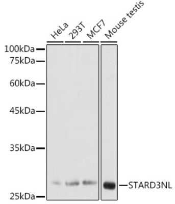 Western Blot: STARD3NL Antibody [NBP2-94673] - Western blot analysis of extracts of various cell lines, using STARD3NL antibody (NBP2-94673) at 1:1000 dilution. Secondary antibody: HRP Goat Anti-Rabbit IgG (H+L) at 1:10000 dilution. Lysates/proteins: 25ug per lane. Blocking buffer: 3% nonfat dry milk in TBST. Detection: ECL Basic Kit. Exposure time: 30s.