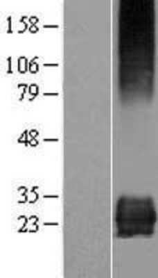 Western Blot: STARD3NL Overexpression Lysate (Adult Normal) [NBP2-06089] Left-Empty vector transfected control cell lysate (HEK293 cell lysate); Right -Over-expression Lysate for STARD3NL.