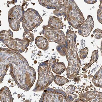 Immunohistochemistry-Paraffin STARD4 Antibody