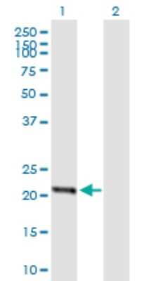 Western Blot: STARD4 Antibody [H00134429-B01P] - Analysis of STARD4 expression in transfected 293T cell line by STARD4 polyclonal antibody.  Lane 1: STARD4 transfected lysate(22.55 KDa). Lane 2: Non-transfected lysate.