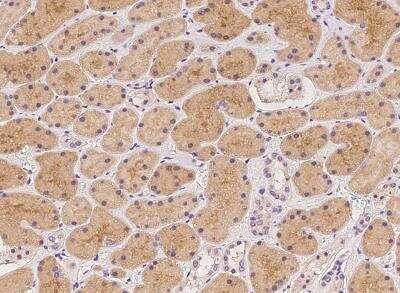 Immunohistochemistry-Paraffin: STARD5 Antibody [NBP3-05985] -  Staining of human STARD5 in human kidney with rabbit polyclonal antibody at 1:500 dilution.