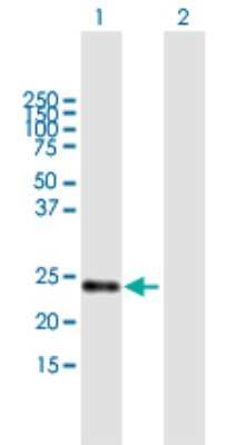 Western Blot: STARD5 Antibody [H00080765-B02P] - Analysis of STARD5 expression in transfected 293T cell line by STARD5 polyclonal antibody.  Lane 1: STARD5 transfected lysate(23.80 KDa). Lane 2: Non-transfected lysate.